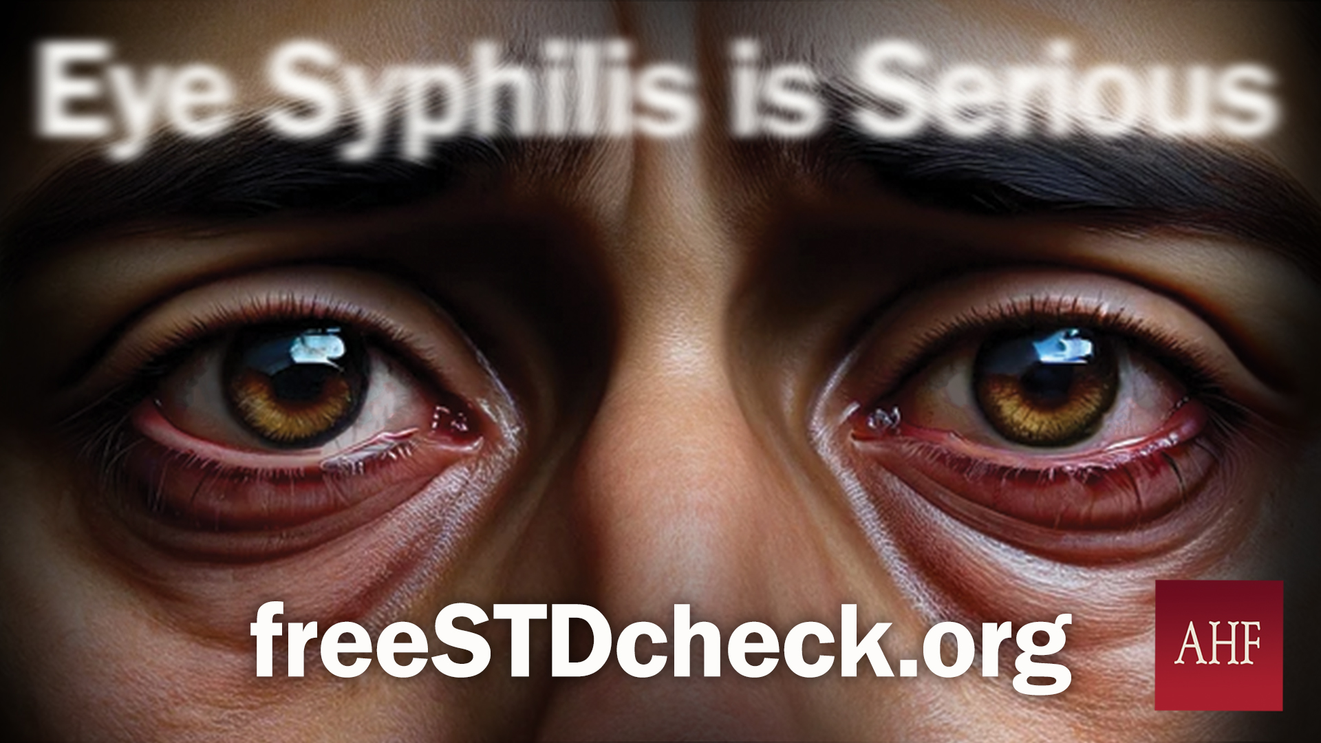 Featured image for ““Eye Syphilis is Serious” Campaign Description & Collateral”